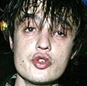 Pete Doherty �r fulaste mannen i v�rlden